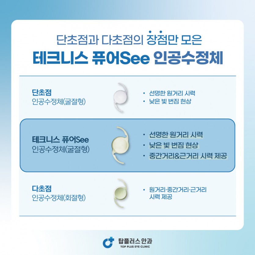 주목받는 백내장렌즈 ‘퓨어씨(Pure see)’ 광명지역 내 선도입 > 공지사항 | 탑플러스안과